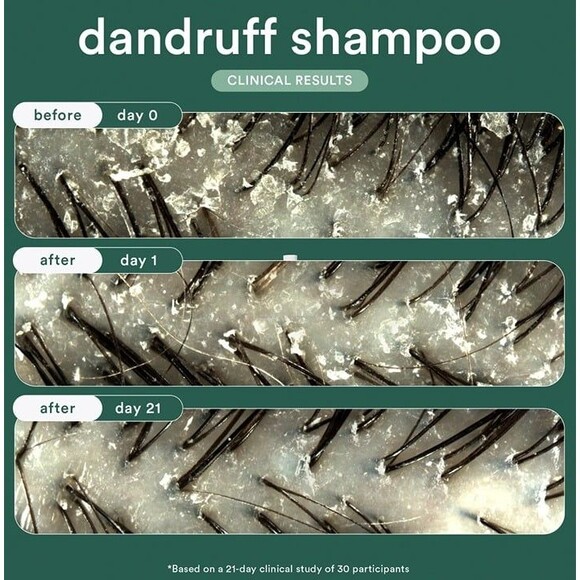 NEW VERB Dandruff Shampoo Moisturizing Non Stripping Salicylic Acid Dry Scalp - Picture 4 of 12